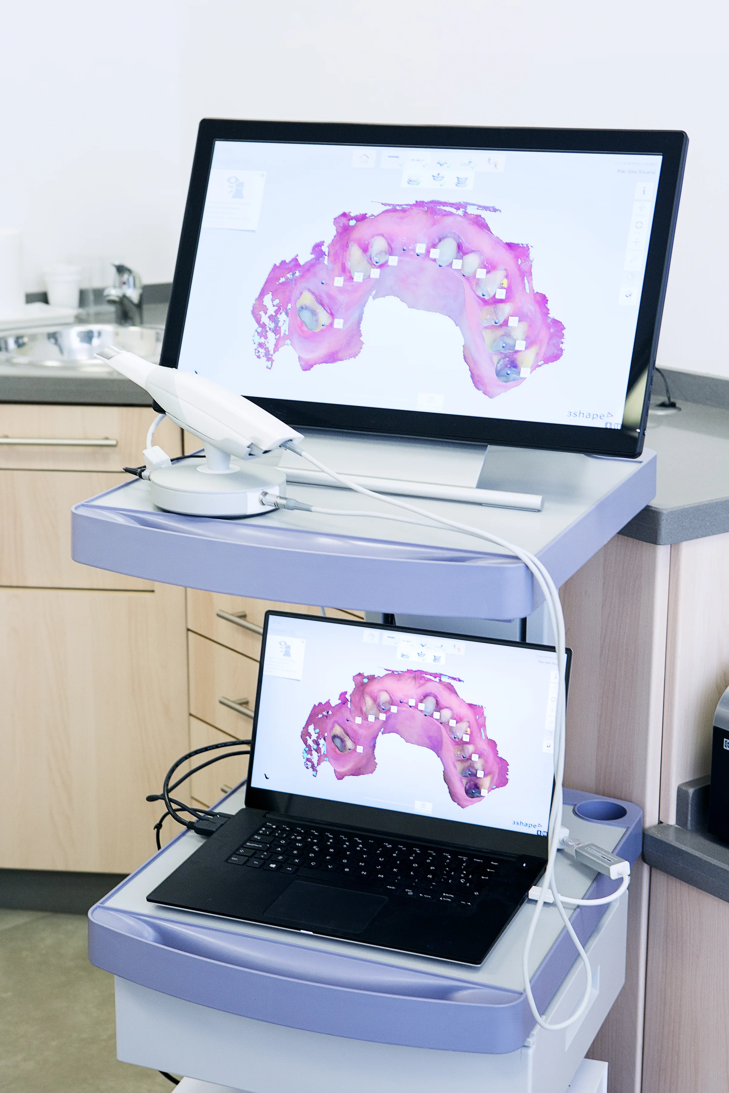 Implant dentaire en Tunisie : guide complet 2026